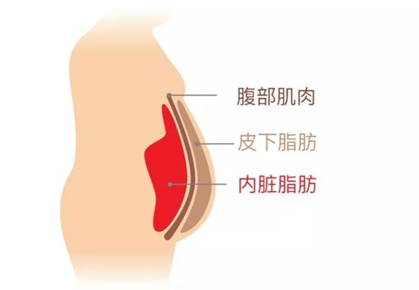 ng娱乐为您讲解:内脏脂肪要怎么减